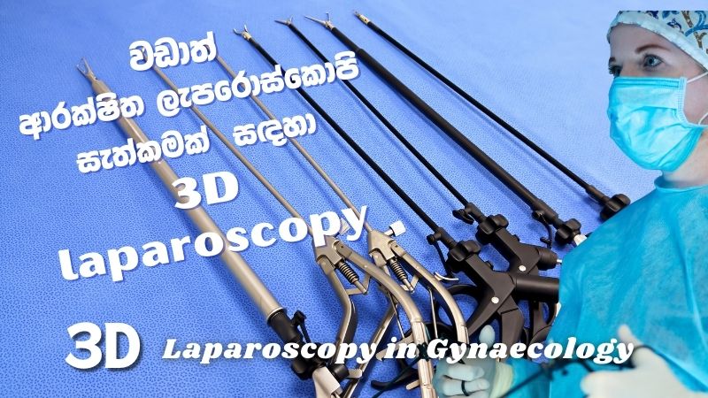 3D-4K-Laparoscopy