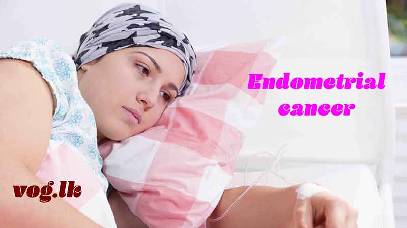 ගර්භාෂයේ_පිළිකා_හඳුනා_ගන්නේ_කොහොමද?_(Endometrial_Cancer)